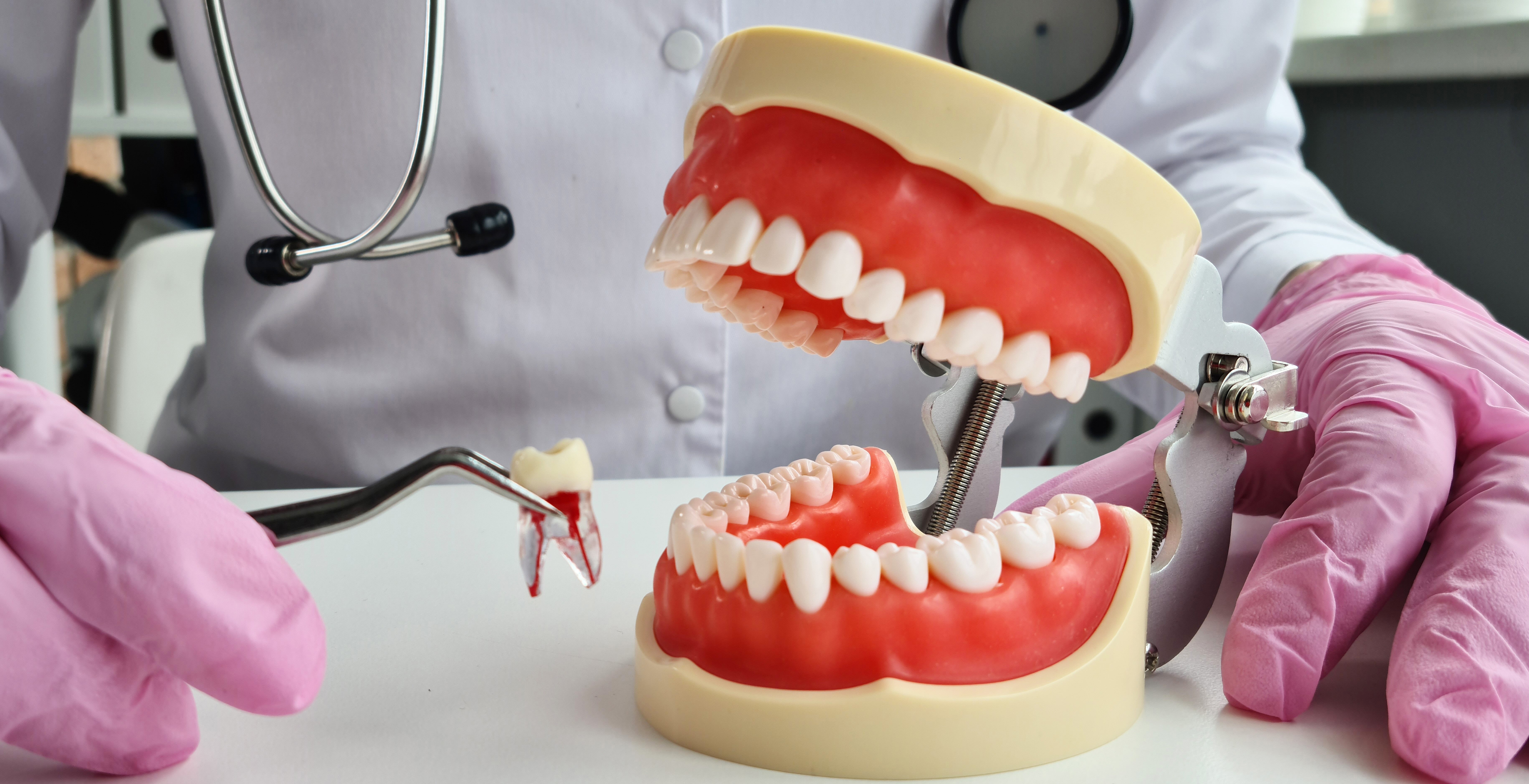 What to Expect from a Tooth Extraction at Dublin Corners Dental in Pleasanton, CA