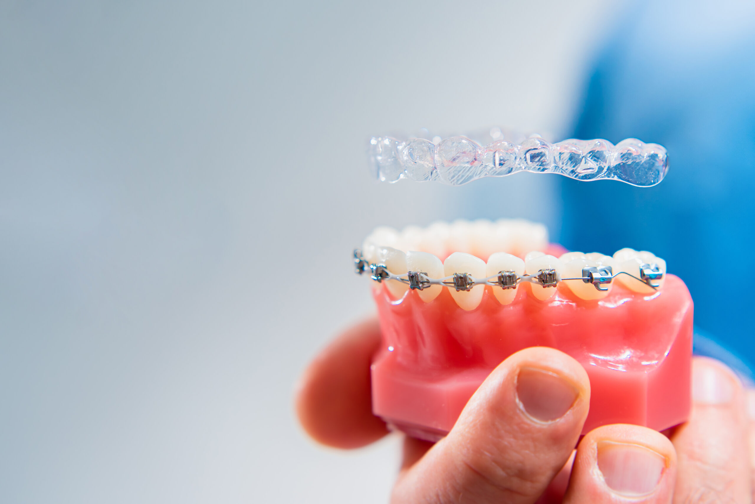 Braces vs. Invisalign: Which is Right for You?